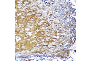 Immunohistochemistry of paraffin-embedded Human esophageal using CYB5R1 Rabbit pAb (ABIN7266630) at dilution of 1:100 (40x lens). (CYB5R1 Antikörper  (AA 1-305))