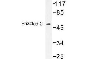 Image no. 1 for anti-Frizzled Family Receptor 2 (FZD2) antibody (ABIN317860)