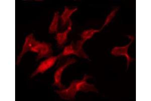 ABIN6274348 staining HuvEc by IF/ICC. (TNFAIP1 Antikörper  (Internal Region))