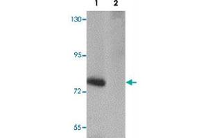 Western blot analysis of SESTD1 in rat brain tissue lysate with SESTD1 polyclonal antibody  at 1 ug/mL in (1) the absence and (2) the presence of blocking peptide. (SESTD1 Antikörper  (C-Term))