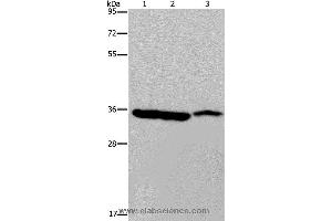 Western blot analysis of Mouse heart, liver and stomach tissue, using MDH1 Polyclonal Antibody at dilution of 1:500 (MDH1 Antikörper)