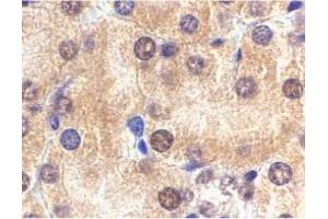 Immunohistochemistry of Il1rl1 in mouse kidney tissue with Il1rl1 polyclonal antibody  at 2 ug/mL . (IL1RL1 Antikörper  (N-Term))