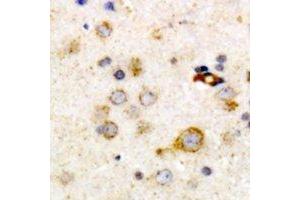 Immunohistochemical analysis of Clusterin staining in human brain formalin fixed paraffin embedded tissue section.