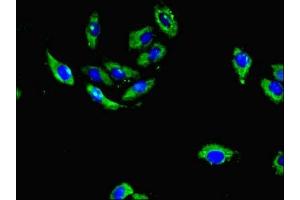 Immunofluorescent analysis of A549 cells using ABIN7142053 at dilution of 1:100 and Alexa Fluor 488-congugated AffiniPure Goat Anti-Rabbit IgG(H+L) (PLCD4 Antikörper  (AA 1-290))