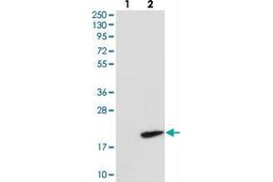 Western blot analysis of Lane 1: Negative control (vector only transfected HEK293T lysate), Lane 2: Over-expression Lysate (Co-expressed with a C-terminal myc-DDK tag (~3. (RNF7 Antikörper)
