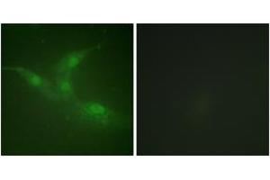 Immunofluorescence analysis of NIH-3T3 cells, using Breast Tumor Kinase (Phospho-Tyr447) Antibody. (PTK6 Antikörper  (pTyr447))