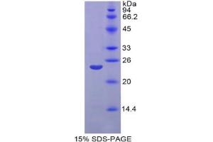 SDS-PAGE analysis of Rat Matrix Metalloproteinase 11 (MMP11) Protein. (MMP11 Protein)
