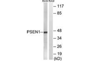 Western blot analysis of extracts from Raw264. (Presenilin 1 Antikörper  (AA 323-372))
