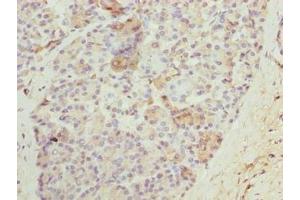 Immunohistochemistry of paraffin-embedded human pancreatic tissue using ABIN7161122 at dilution of 1:100 (N4BP2L2 Antikörper  (AA 1-300))