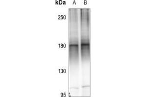 Western blot analysis of MEKK4 expression in A549 (A), EC9706 (B) whole cell lysates. (MAP3K4 Antikörper  (C-Term))