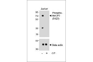 Western blot analysis of lysates from Jurkat cell line, untreated or treated with calf intestinal alkaline phosphatase(CIP), using Phospho-MeCP2 Antibody (upper) or Beta-actin (lower). (MECP2 Antikörper  (pSer423))