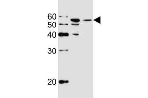 Western blot analysis of lysate from MCF-7, T47D cell line (left to right) using ALDH6A1 antibody at 1:1000 for each lane. (ALDH6A1 Antikörper)