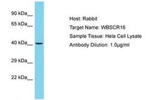 WBSCR16 antibody  (AA 115-164)