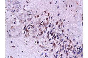Formalin-fixed and paraffin embedded: rat brain tissue labeled with Anti-FasL Polyclonal Antibody, Unconjugated (ABIN726410) at 1:200, followed by conjugation to the secondary antibody and DAB staining (FASL Antikörper  (AA 196-281))