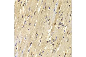 Immunohistochemistry of paraffin-embedded Mouse heart using TOPBP1 antibody at dilution of 1:100 (x40 lens).