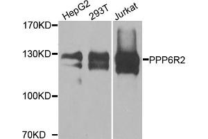 Western blot analysis of extracts of various cell lines, using PPP6R2 antibody. (SAPS2 Antikörper)