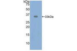 Western blot analysis of recombinant Human VEGFR2. (VEGFR2/CD309 Antikörper  (AA 46-320))