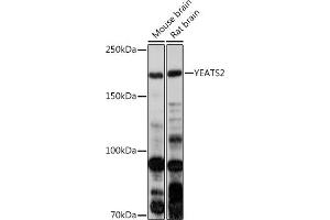 Western blot analysis of extracts of various cell lines, using YE antibody (ABIN7271413) at 1:1000 dilution. (YEATS2 Antikörper)