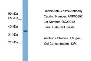 Western Blotting (WB) image for anti-Sprouty RTK Signaling Antagonist 4 (SPRY4) (Middle Region) antibody (ABIN2784290)
