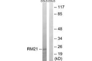 Western Blotting (WB) image for anti-Mitochondrial Ribosomal Protein L21 (MRPL21) (AA 131-180) antibody (ABIN2890052) (MRPL21 Antikörper  (AA 131-180))