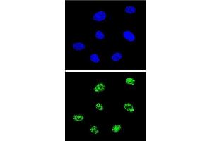 Confocal immunofluorescent analysis of TP73 Antibody (Center) (ABIN652829 and ABIN2842541) with 293 cell followed by Alexa Fluor® 488-conjugated goat anti-rabbit lgG (green). (Tumor Protein p73 Antikörper  (AA 288-317))