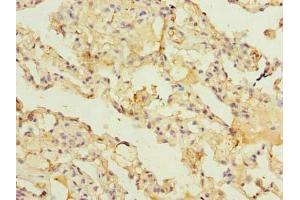 Immunohistochemistry of paraffin-embedded human lung tissue using ABIN7143477 at dilution of 1:100 (ARL11 Antikörper  (AA 2-196))