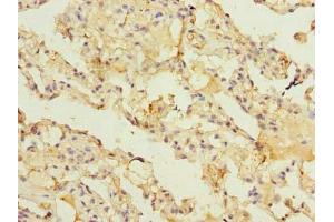 Immunohistochemistry of paraffin-embedded human lung tissue using ABIN7143477 at dilution of 1:100 (ARL11 Antikörper  (AA 2-196))