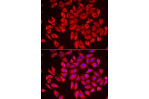Immunofluorescence analysis of U2OS cell using DCAF7 antibody. (DCAF7 Antikörper)