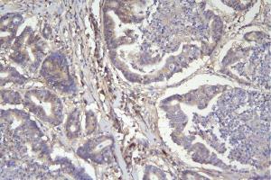 IHC analysis of CD46 using anti-CD46 antibody (ABIN7602758). (CD46 Antikörper  (C-Term))