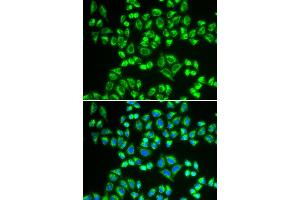Immunofluorescence analysis of HeLa cell using SHMT2 antibody. (SHMT2 Antikörper)