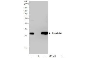 IP Image Immunoprecipitation of Prohibitin protein from 293T whole cell extracts using 5 μg of Prohibitin antibody, Western blot analysis was performed using Prohibitin antibody, EasyBlot anti-Rabbit IgG  was used as a secondary reagent. (Prohibitin Antikörper)