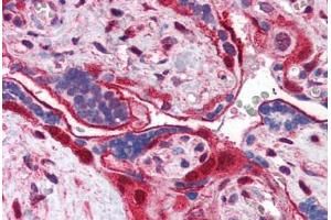 Human Placenta (formalin-fixed, paraffin-embedded) stained with ANXA11 antibody ABIN351460 at 3. (Annexin A11 Antikörper  (AA 8-20))