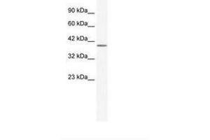 Image no. 1 for anti-Annexin A13 (ANXA13) (AA 62-111) antibody (ABIN203073) (Annexin A13 Antikörper  (AA 62-111))