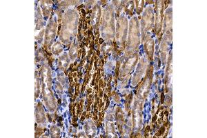 Immunohistochemistry of paraffin-embedded human colon carcinoma using Caspase-8 Rabbit pAb (ABIN6131530, ABIN6137970, ABIN6137972 and ABIN6213676) at dilution of 1:200 (40x lens). (Caspase 8 Antikörper  (AA 1-479))