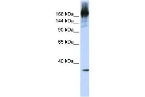 PRPF8 antibody used at 1 ug/ml to detect target protein. (PRPF8 Antikörper)