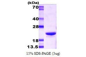 SDS-PAGE (SDS) image for Crystallin, alpha B (CRYAB) (AA 1-175) protein (ABIN666647)