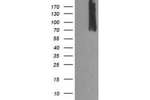 Western Blotting (WB) image for anti-Calpain 9 (CAPN9) antibody (ABIN1497092) (Calpain 9 Antikörper)