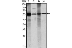 Western blot analysis using ALDH1A1 mouse mAb against Raji (1), Jurkat (2), THP-1 (3) and K562 (4) cell lysate. (ALDH1A1 Antikörper)