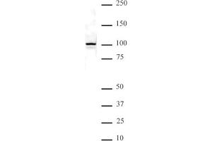 NFkB p100 pAb tested by Western blot.