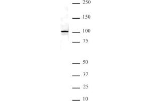 NFkB p100 pAb tested by Western blot. (NFKB2 Antikörper  (C-Term))