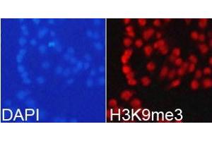 Immunofluorescence analysis of 293T cell using H3K9me3antibody. (Histone 3 Antikörper  (H3K9me3))