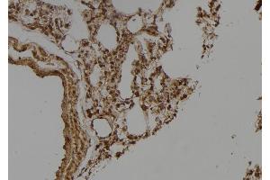 ABIN6275649 at 1/100 staining Rat lung tissue by IHC-P. (Ubiquilin 3 Antikörper  (Internal Region))