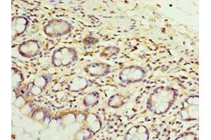 Immunohistochemistry of paraffin-embedded human small intestine tissue using ABIN7152050 at dilution of 1:100 (SULT1E1 Antikörper  (AA 140-294))