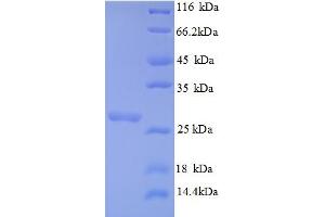 SDS-PAGE (SDS) image for B-Cell CLL/lymphoma 2 (BCL2) (AA 5-205), (partial) protein (His tag) (ABIN5709125)