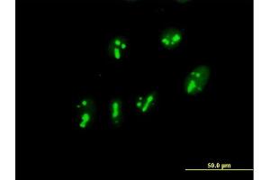 Immunofluorescence of purified MaxPab antibody to PARN on HeLa cell. (PARN Antikörper  (AA 1-639))