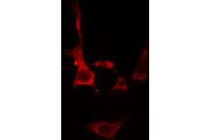ABIN6275701 staining  Hela cells by IF/ICC. (SLC39A1 Antikörper  (Internal Region))