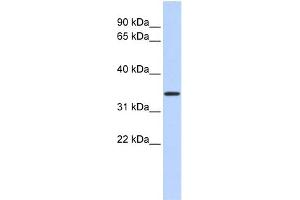 WB Suggested Anti-CCDC90A Antibody Titration:  0. (CCDC90A Antikörper  (Middle Region))