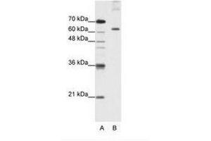 Image no. 2 for anti-Pumilio RNA Binding Family Member 3 (PUM3) (AA 61-110) antibody (ABIN203236) (KIAA0020 Antikörper  (AA 61-110))