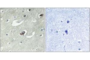 Immunohistochemistry analysis of paraffin-embedded human brain tissue, using KIF20A (Ab-528) Antibody.