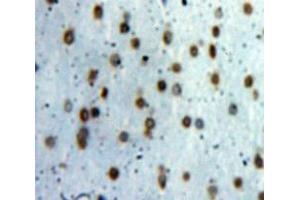 Used in DAB staining on fromalin fixed paraffin-embedded Brain tissue